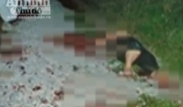 Người phụ nữ thuê người chặt chân, tay từng môi giới mại dâm