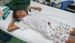 Bé gái 14 tuổi suýt mất chân vì bị rắn chàm quạp cực độc cắn