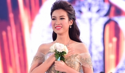 Hoa hậu Mỹ Linh trần tình về nghi án làm răng