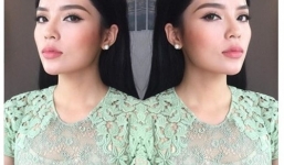 Kỳ Duyên lên tiếng về gương mặt sưng phù, khác lạ