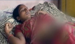 Mẹ chồng đổ axit lên bụng con dâu vì nghi đẻ cháu gái