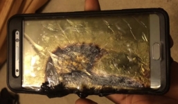 Cậu bé 6 tuổi bị bỏng nặng vì điện thoại phát nổ trên tay