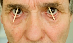 Người đàn ông bị đạn bắn xuyên đầu sống sót nhưng 40 năm không ngủ