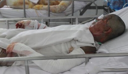 Cô gái bị người tình tẩm xăng đốt ở Sài Gòn đã tử vong