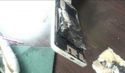 Thêm 1 trường hợp điện thoại bốc cháy khiến người dùng bỏng nặng