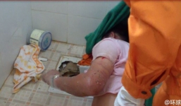 Giải cứu người đàn ông bị mắc kẹt suốt đêm ở bồn cầu