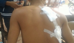 Vác dao chém 3 người hàng xóm chỉ vì mâu thuẫn trong đám cưới