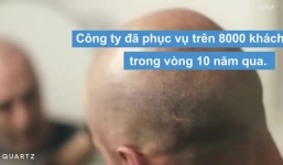 Dịch vụ đắt đỏ gần 5.000 USD xăm tóc cho người hói đầu