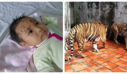 Những vụ động vật hung dữ gây thương vong cho người ở Việt Nam