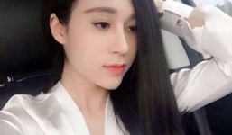 Cô gái chia sẻ sự hối hận khi phẫu thật thẩm mỹ thành hotgirl