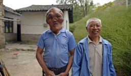 Ông lão có khuôn mặt giống người ngoài hành tinh