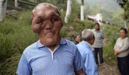 Ông lão có khuôn mặt giống người ngoài hành tinh