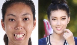 Ngắm nhan sắc mĩ nhân phẫu thuật thẩm mỹ từng bị bạn trai bỏ vì xấu xí