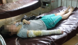 Người vợ bị chồng dội nước sôi vì đi xăm chân mày