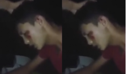 'Tổ lái' tăng động cày mặt xuống đường vì nhún nhảy trên xe