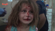 Bé gái mặt chảy máu, khóc tìm bố sau cuộc không kích Syria