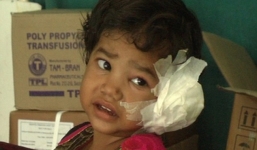 Hãi hùng cảnh 80 con sâu làm tổ trong tai bé gái