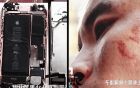 iPhone 7 phát nổ làm bị thương 1 người đàn ông Trung Quốc