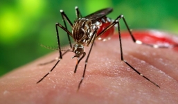 Bé sơ sinh đầu tiên nghi dị tật đầu nhỏ do virus Zika ở Việt Nam