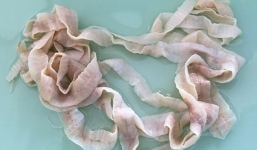 Hãi hùng sán dây 12m làm tổ trong bụng bé trai 3 tuổi