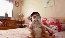 Nghị lực phi thường của cô gái 17 tuổi trong thân hình trẻ sơ sinh