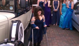 Cô gái chấp nhận đau đớn để kéo chân dài thêm 18cm