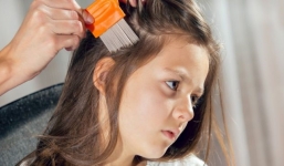 Kiếm bộn tiền nhờ mở dịch vụ diệt chấy 300 USD/lần