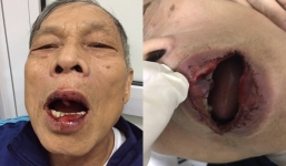 Va chạm giao thông, cán bộ 7X đấm rách miệng vị tiến sĩ U80