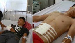 Hai chiến sĩ Công an bị đâm khi đang làm nhiệm vụ