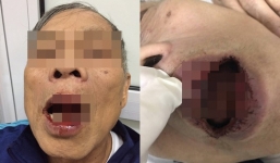 Vụ tiến sĩ 76 tuổi nghi bị cán bộ Sở Ngoại vụ đánh: Công an vào cuộc