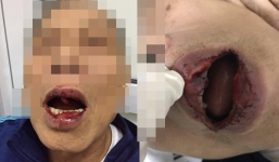 Tin tức mới nhất vụ cán bộ Sở Ngoại vụ nghi hành hung tiến sĩ 76 tuổi