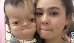 Xúc động hình ảnh mẹ chụp cùng con gái dị tật đang lan truyền trên mạng xã hội