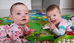 Hy hữu cặp song sinh thụ thai cách nhau chỉ 10 ngày