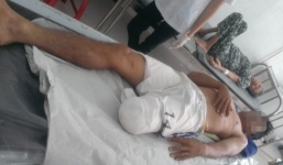 Nhân viên y tế tự cắt chân sẽ được chuyển qua BV tâm thần điều trị