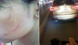 Triệu tập tài xế ô tô tát cô gái sưng mặt vì chưa kịp nhường đường