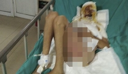 Vụ nổ bốt điện ở Hà Đông: 2 vợ chồng chủ quán trà đá nguy kịch