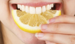 5 cách làm trắng răng với nguyên liệu từ nhà bếp đơn giản nhất 