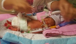 Sản phụ Việt sang Singapore thăm chồng bất ngờ sinh non phải trả 6 tỷ đồng viện phí