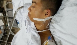 Chàng trai xứ Nghệ cho ô tô cán nát tay để cứu bạn?