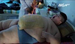 Hãi hùng cảnh châm lửa đốt cháy mỡ bụng cho người béo phì