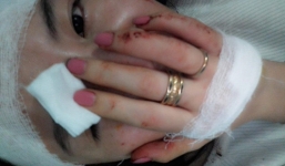 Cô gái tố bị nữ giáo viên cấp 2 bắt cóc, hành hung dã man trên taxi