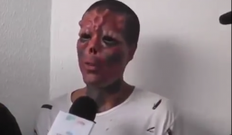 Người đàn ông bạo tay chi gần 900 triệu để biến mình thành “dị nhân”