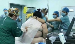 Huy động 16 nhân viên y tế mổ đẻ cho sản phụ 140 kg