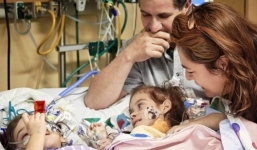 Cặp chị em song sinh dính liền hội ngộ với 2 cơ thể riêng biệt