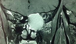 Hy hữu chàng trai được cứu khỏi bị mù trước ngày cưới