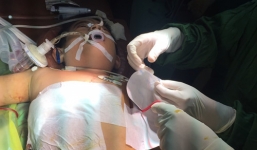 Nam thanh niên bị người lạ bổ bồ cào cắm sâu vào vai