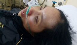 Thầy giáo cấp 3 đánh em gái họ chấn thương sọ não