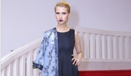 Nữ người mẫu cao nhất Việt Nam nhập viện phẫu thuật vì mất thị lực