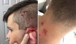 Bị mèo tấn công vì quá phấn khích khi mở quà giáng sinh