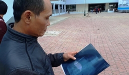 Bộ Y tế vào cuộc vụ bác sỹ để quên kéo trong bụng bệnh nhân 18 năm